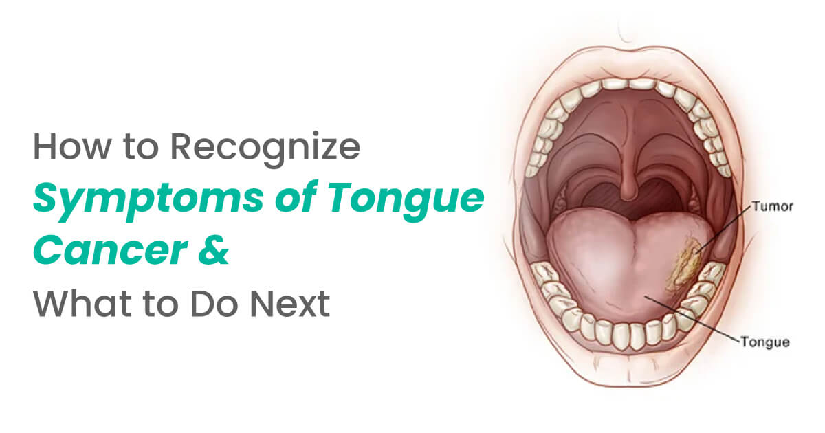 This Common Habit Can Cause Oral Cancer (Most People Ignore It)