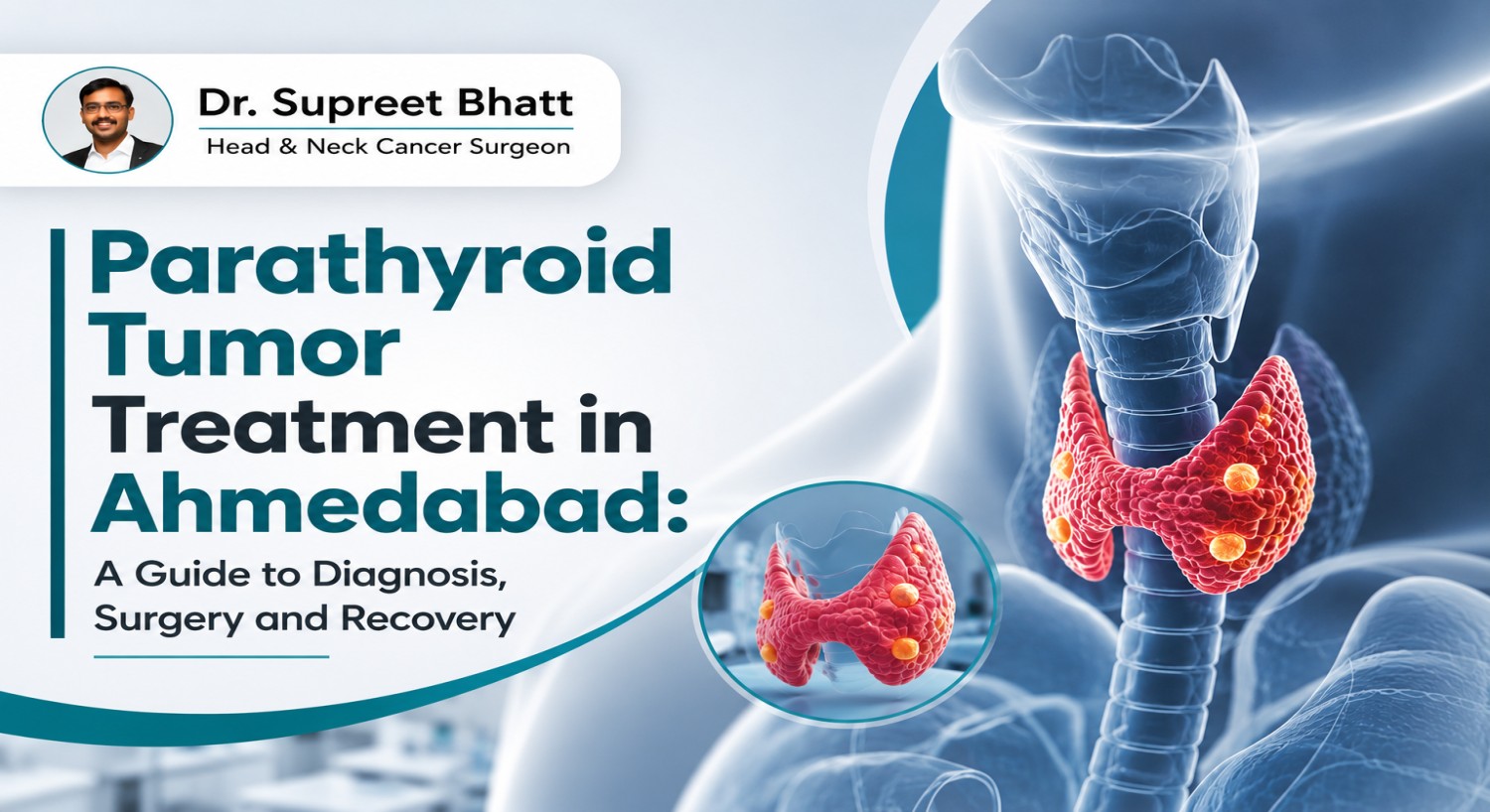 Parathyroid Tumor Treatment in Ahmedabad: A Guide to Diagnosis, Surgery and Recovery
