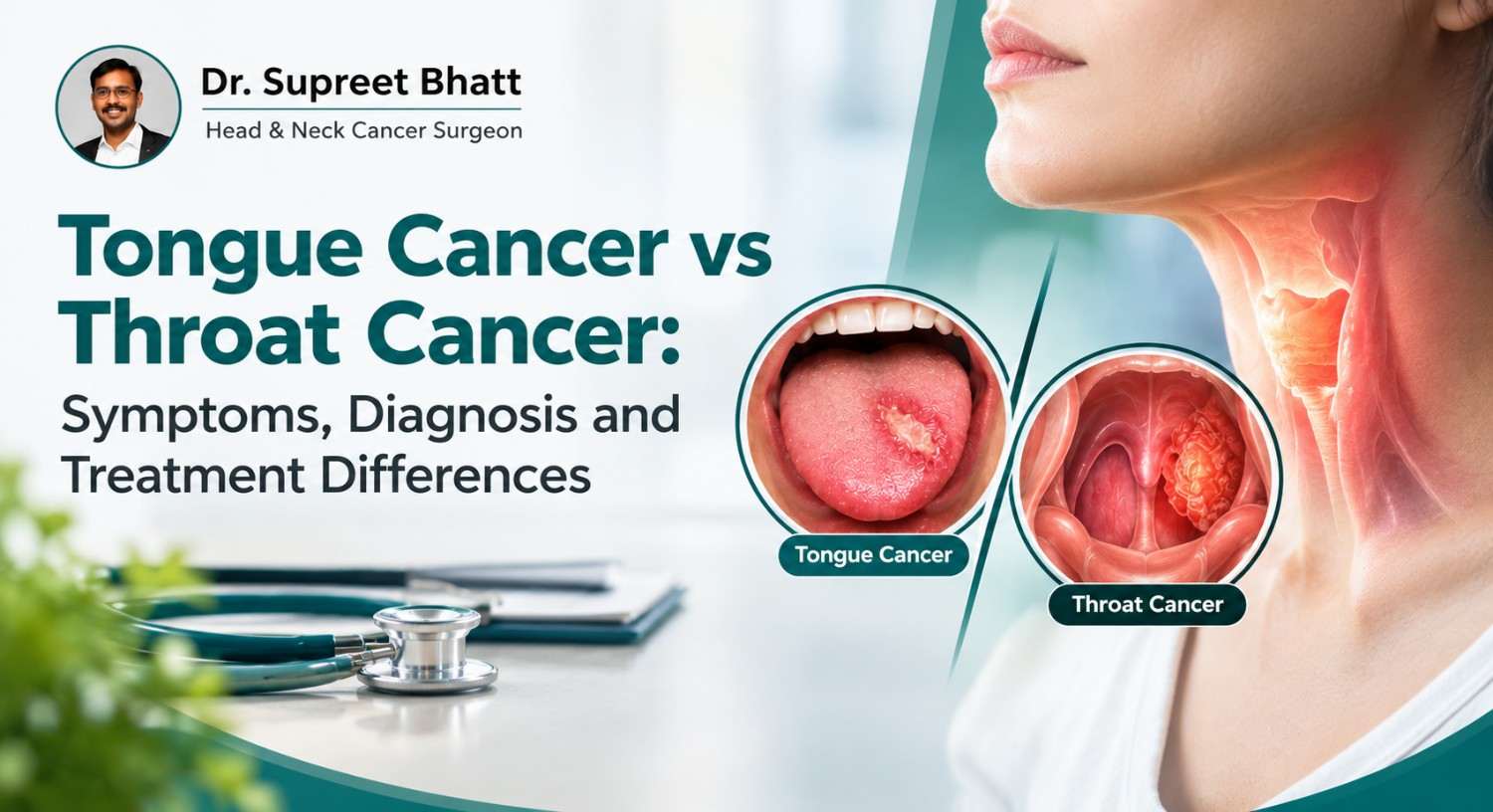 Tongue Cancer vs Throat Cancer: Symptoms, Diagnosis and Treatment Differences
