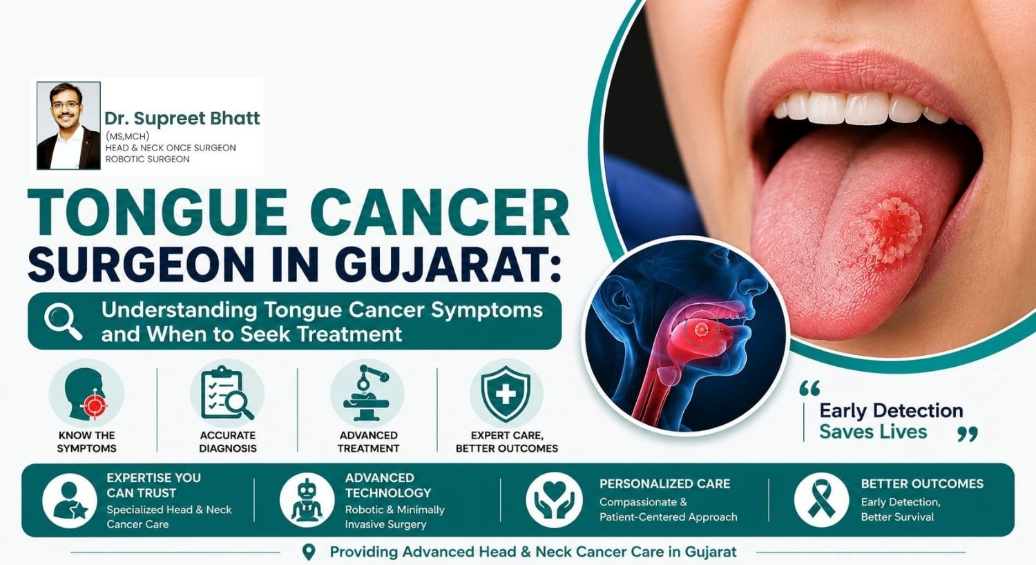 Tongue Cancer Surgeon in Gujarat: Understanding Tongue Cancer Symptoms and When to Seek Treatment