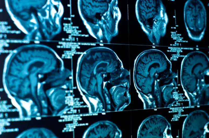 Anterior Skull Base Surgeon In Ahmedabad anterior_skull_base_surgeon_in_ahmedabad