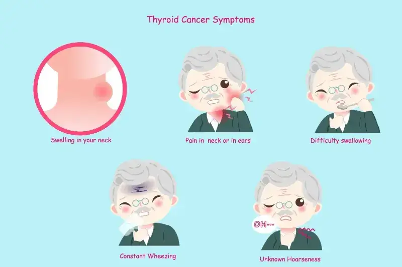 Thyroid Cancer Symptoms thyroid_cancer_symptoms